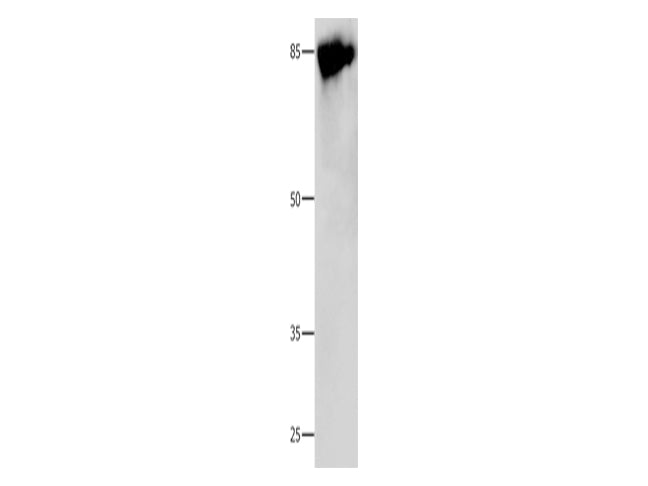 Caldesmon Polyclonal Antibody Store at -20°C - MSE Supplies LLC