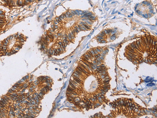 CA9 Polyclonal Antibody Store at -20°C - MSE Supplies LLC