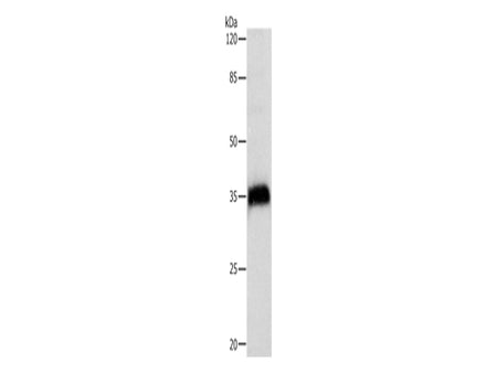 CTSZ Polyclonal Antibody Store at -20°C - MSE Supplies LLC