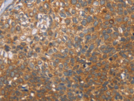 CCL21 Polyclonal Antibody Store at -20°C - MSE Supplies LLC