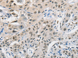 CDC27 Polyclonal Antibody Store at -20°C - MSE Supplies LLC