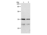 CDK4 Polyclonal Antibody Store at -20°C - MSE Supplies LLC