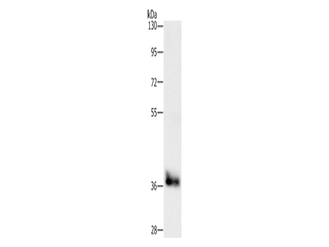 CEBP Epsilon Polyclonal Antibody Store at -20°C - MSE Supplies LLC