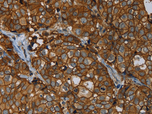 ERBB4 Polyclonal Antibody Store at -20°C - MSE Supplies LLC