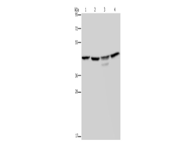 CSNK2A1 Polyclonal Antibody Store at -20°C - MSE Supplies LLC