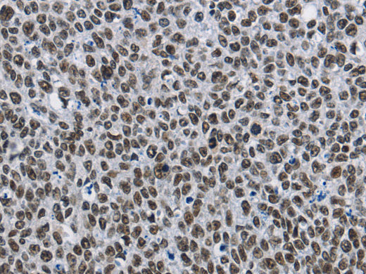 CMTM2 Polyclonal Antibody Store at -20°C - MSE Supplies LLC