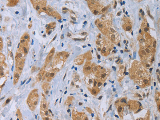 CLEC1A Polyclonal Antibody Store at -20°C - MSE Supplies LLC