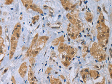 CLEC1A Polyclonal Antibody Store at -20°C - MSE Supplies LLC