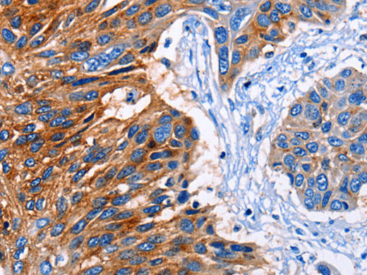CLEC2B Polyclonal Antibody Store at -20°C - MSE Supplies LLC