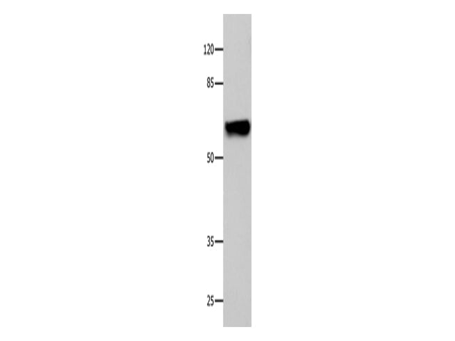 CNGA2 Polyclonal Antibody Store at -20°C - MSE Supplies LLC