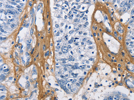 COL3A1 Polyclonal Antibody Store at -20°C - MSE Supplies LLC