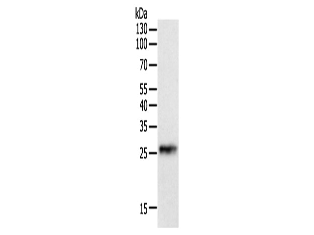 CRP Polyclonal Antibody Store at -20°C - MSE Supplies LLC