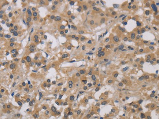 DCN Polyclonal Antibody Store at -20°C - MSE Supplies LLC