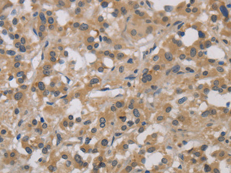 DCN Polyclonal Antibody Store at -20°C - MSE Supplies LLC