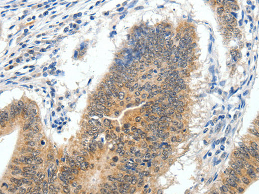ECE2 Polyclonal Antibody Store at -20°C - MSE Supplies LLC