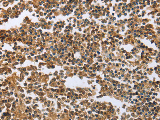 ECE1 Polyclonal Antibody Store at -20°C - MSE Supplies LLC