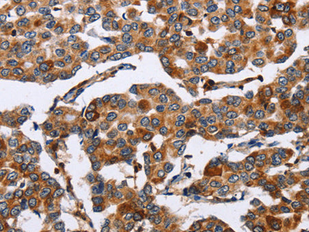 ENPP5 Polyclonal Antibody Store at -20°C - MSE Supplies LLC