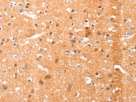 Ephrin A1 Polyclonal Antibody Store at -20°C - MSE Supplies LLC