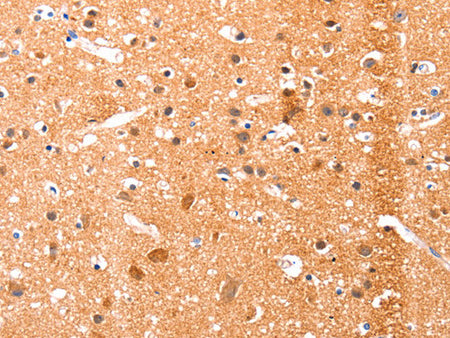 Ephrin A1 Polyclonal Antibody Store at -20°C - MSE Supplies LLC