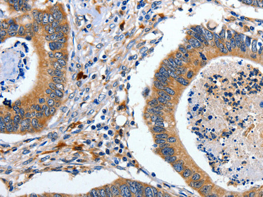 EFNB2 Polyclonal Antibody Store at -20°C - MSE Supplies LLC