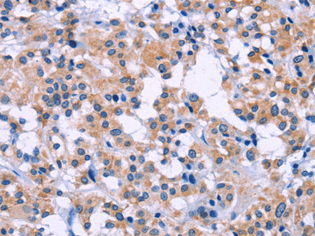 DUSP22 Polyclonal Antibody Store at -20°C - MSE Supplies LLC