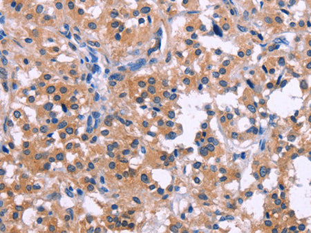 DUSP13 Polyclonal Antibody Store at -20°C - MSE Supplies LLC