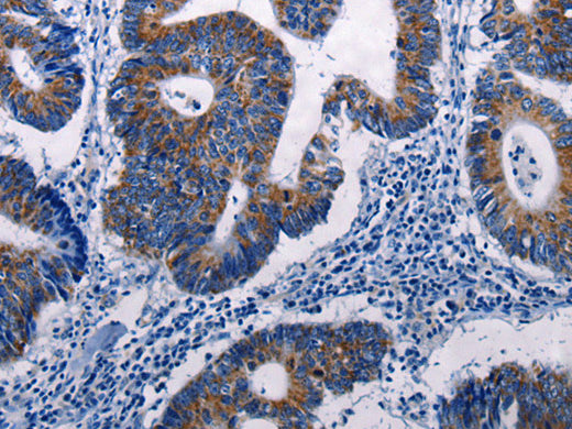 MKP-3 Polyclonal Antibody Store at -20°C - MSE Supplies LLC