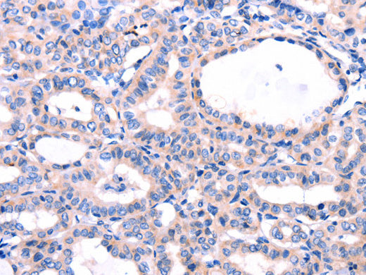 DUSP12 Polyclonal Antibody Store at -20°C - MSE Supplies LLC