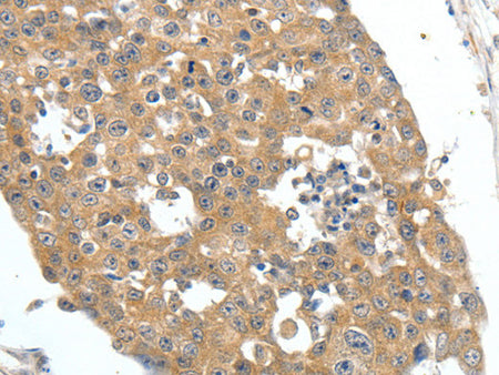 FSHR Polyclonal Antibody Store at -20°C - MSE Supplies LLC