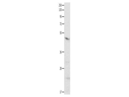 GNAS Polyclonal Antibody Store at -20°C - MSE Supplies LLC