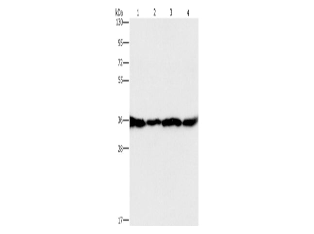 GNB1 Polyclonal Antibody Store at -20°C - MSE Supplies LLC