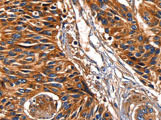 Galectin 8 Polyclonal Antibody Store at -20°C - MSE Supplies LLC