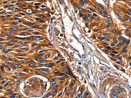 Galectin 8 Polyclonal Antibody Store at -20°C - MSE Supplies LLC