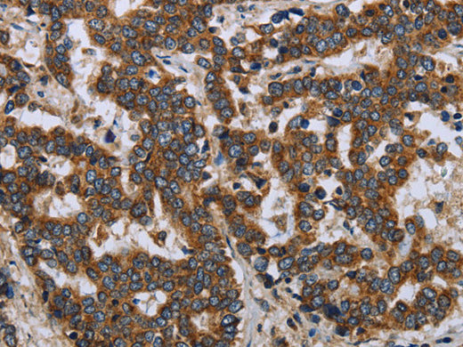 LGALS2 Polyclonal Antibody Store at -20°C - MSE Supplies LLC