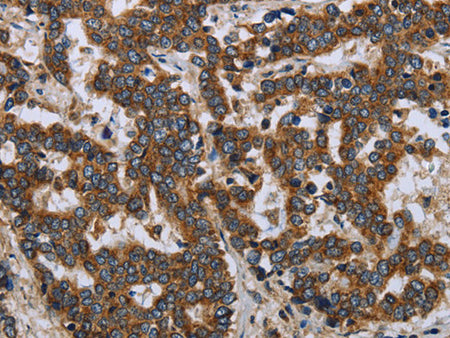 LGALS2 Polyclonal Antibody Store at -20°C - MSE Supplies LLC
