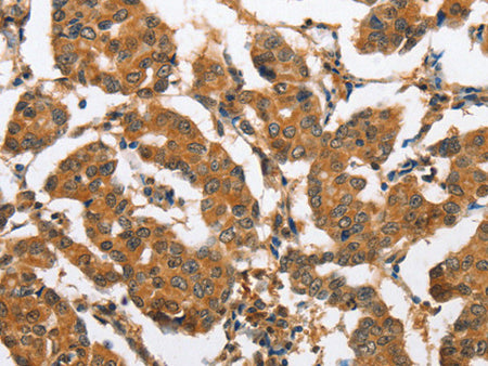 CXCL14 Polyclonal Antibody Store at -20°C - MSE Supplies LLC