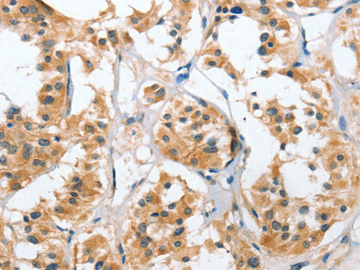 UGCG Polyclonal Antibody Store at -20°C - MSE Supplies LLC