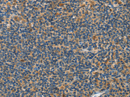 GRB7 Polyclonal Antibody Store at -20°C - MSE Supplies LLC