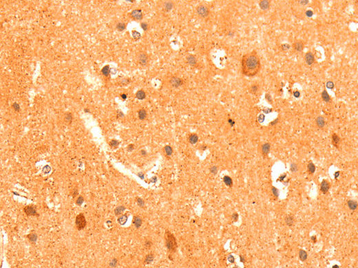 GRM3 Polyclonal Antibody Store at -20°C - MSE Supplies LLC