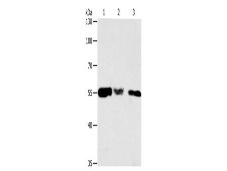 CALR Polyclonal Antibody Store at -20°C - MSE Supplies LLC