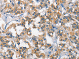 SCARB1 Polyclonal Antibody Store at -20°C - MSE Supplies LLC