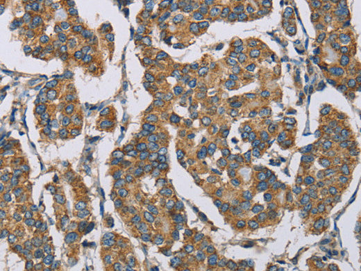 HDAC6 Polyclonal Antibody Store at -20°C - MSE Supplies LLC