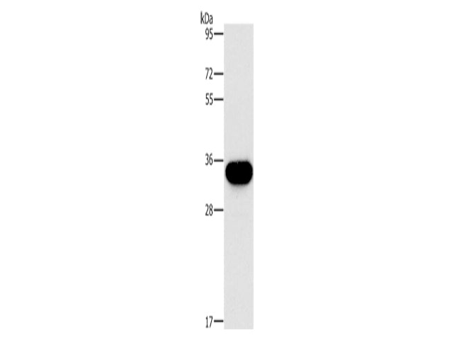 HOXB13 Polyclonal Antibody Store at -20°C - MSE Supplies LLC