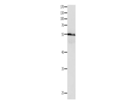 HP Polyclonal Antibody Store at -20°C - MSE Supplies LLC