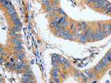 HSPA1A Polyclonal Antibody Store at -20°C - MSE Supplies LLC
