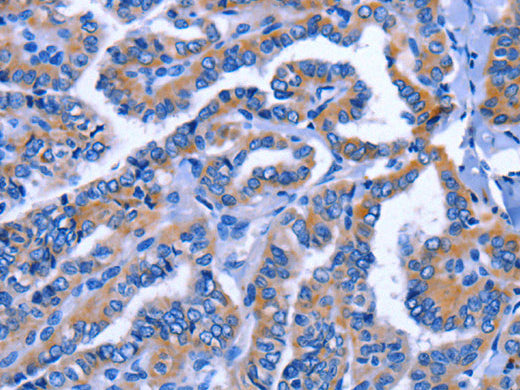 IGSF10 Polyclonal Antibody Store at -20°C - MSE Supplies LLC