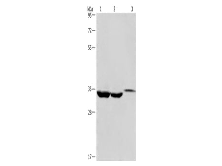 ING2 Polyclonal Antibody Store at -20°C - MSE Supplies LLC