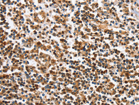 IRAK3 Polyclonal Antibody Store at -20°C - MSE Supplies LLC
