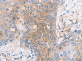 CD85d Polyclonal Antibody Store at -20°C - MSE Supplies LLC
