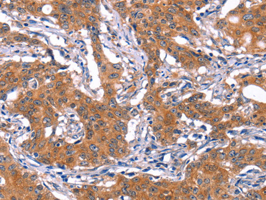 IRS1 Polyclonal Antibody Store at -20°C - MSE Supplies LLC